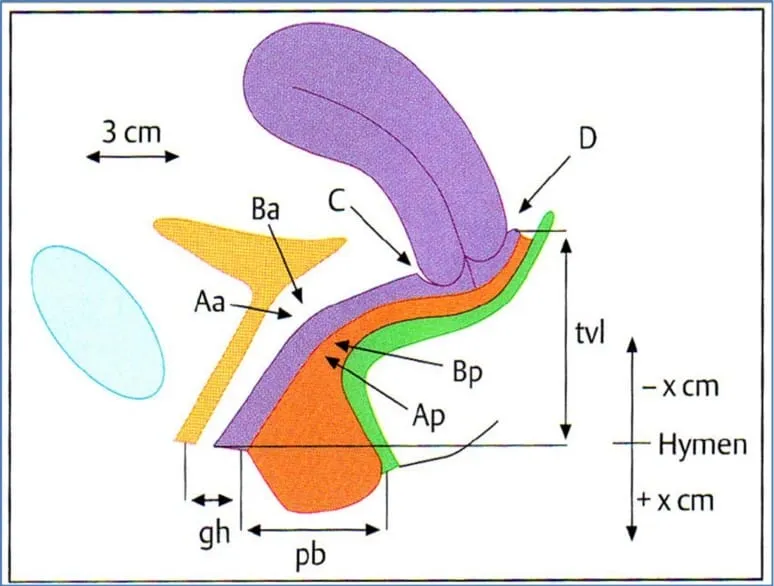 Phân loại - Phân độ sa tạng chậu